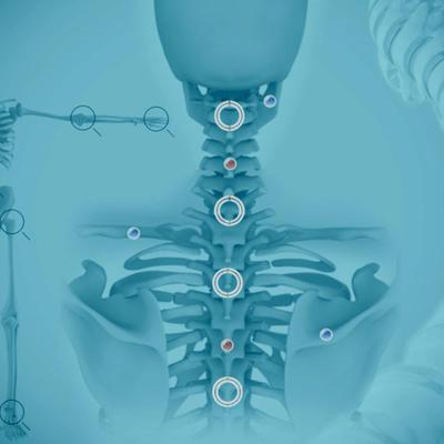 Up&rsquo;Ostéo : l&rsquo;application pour les ostéopathes par des ostéopathes !